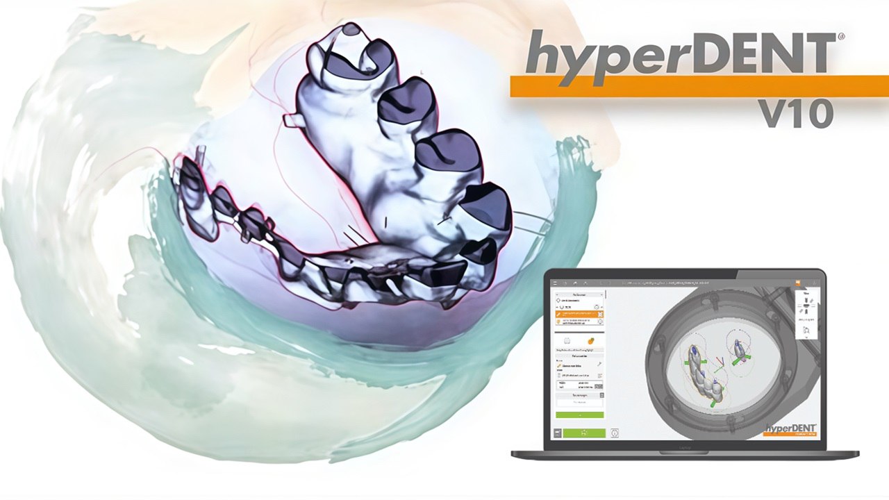 hyperDENT v10.0.2